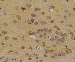 HSP70 Antibody in Immunohistochemistry (Paraffin) (IHC (P))