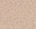 p21 ARC Antibody in Immunohistochemistry (Paraffin) (IHC (P))