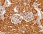 SPTBN1 Antibody in Immunohistochemistry (Paraffin) (IHC (P))