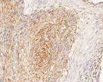 GRIK4 Antibody in Immunohistochemistry (Paraffin) (IHC (P))