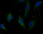 SAPAP1 Antibody in Immunocytochemistry (ICC/IF)