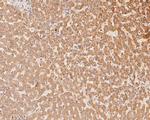 NAT1 Antibody in Immunohistochemistry (Paraffin) (IHC (P))