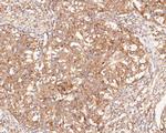 NAT1 Antibody in Immunohistochemistry (Paraffin) (IHC (P))