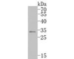 NAT1 Antibody in Western Blot (WB)