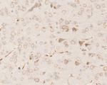 RARS Antibody in Immunohistochemistry (Paraffin) (IHC (P))