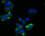 PKP3 Antibody in Immunocytochemistry (ICC/IF)