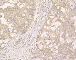 PKP3 Antibody in Immunohistochemistry (Paraffin) (IHC (P))