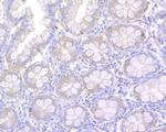 Nodal Antibody in Immunohistochemistry (Paraffin) (IHC (P))