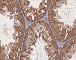 MST1 (STK4) Antibody in Immunohistochemistry (Paraffin) (IHC (P))