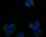 OTC Antibody in Immunocytochemistry (ICC/IF)