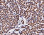 OTC Antibody in Immunohistochemistry (Paraffin) (IHC (P))