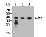 OTC Antibody in Western Blot (WB)