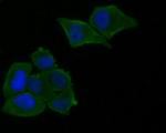 Munc13-4 Antibody in Immunocytochemistry (ICC/IF)