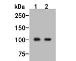 PDE2A Antibody in Western Blot (WB)