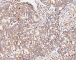 ARF4 Antibody in Immunohistochemistry (Paraffin) (IHC (P))