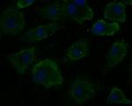 CHMP2A Antibody in Immunocytochemistry (ICC/IF)