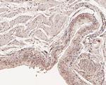 CHMP2A Antibody in Immunohistochemistry (Paraffin) (IHC (P))