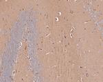 RALA Antibody in Immunohistochemistry (Paraffin) (IHC (P))