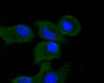 Syk Antibody in Immunocytochemistry (ICC/IF)