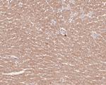 Syk Antibody in Immunohistochemistry (Paraffin) (IHC (P))