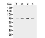 ACVR2A Antibody in Western Blot (WB)