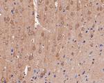 GABRG1 Antibody in Immunohistochemistry (Paraffin) (IHC (P))