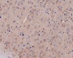 INHBB Antibody in Immunohistochemistry (Paraffin) (IHC (P))