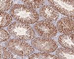 p70 S6 Kinase beta Antibody in Immunohistochemistry (Paraffin) (IHC (P))