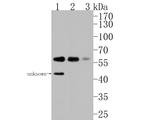 p70 S6 Kinase beta Antibody in Western Blot (WB)