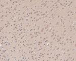 ATG14 Antibody in Immunohistochemistry (Paraffin) (IHC (P))