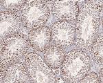 ATG14 Antibody in Immunohistochemistry (Paraffin) (IHC (P))