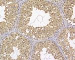 UAP56 Antibody in Immunohistochemistry (Paraffin) (IHC (P))