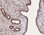 SNX9 Antibody in Immunohistochemistry (Paraffin) (IHC (P))