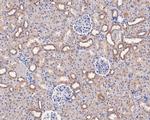 CD49c (Integrin alpha 3) Antibody in Immunohistochemistry (Paraffin) (IHC (P))