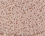 TCF21 Antibody in Immunohistochemistry (Paraffin) (IHC (P))