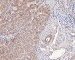 MCRS1 Antibody in Immunohistochemistry (Paraffin) (IHC (P))