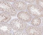 MCRS1 Antibody in Immunohistochemistry (Paraffin) (IHC (P))