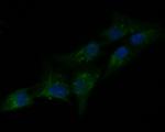 PAI1 Antibody in Immunocytochemistry (ICC/IF)