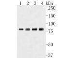 THOC5 Antibody in Western Blot (WB)