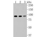 beta Galactosidase Antibody in Western Blot (WB)