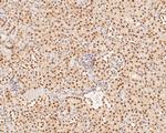 XPA Antibody in Immunohistochemistry (Paraffin) (IHC (P))