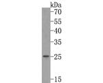 RAB3d Antibody in Western Blot (WB)