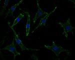 PPP1R9A Antibody in Immunocytochemistry (ICC/IF)