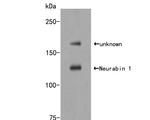 PPP1R9A Antibody in Western Blot (WB)