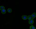 VLDLR Antibody in Immunocytochemistry (ICC/IF)