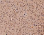 VLDLR Antibody in Immunohistochemistry (Paraffin) (IHC (P))