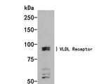 VLDLR Antibody in Western Blot (WB)