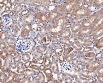 CYP24A1 Antibody in Immunohistochemistry (Paraffin) (IHC (P))