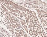 TSC1 Antibody in Immunohistochemistry (Paraffin) (IHC (P))