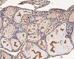 PFKFB2 Antibody in Immunohistochemistry (Paraffin) (IHC (P))